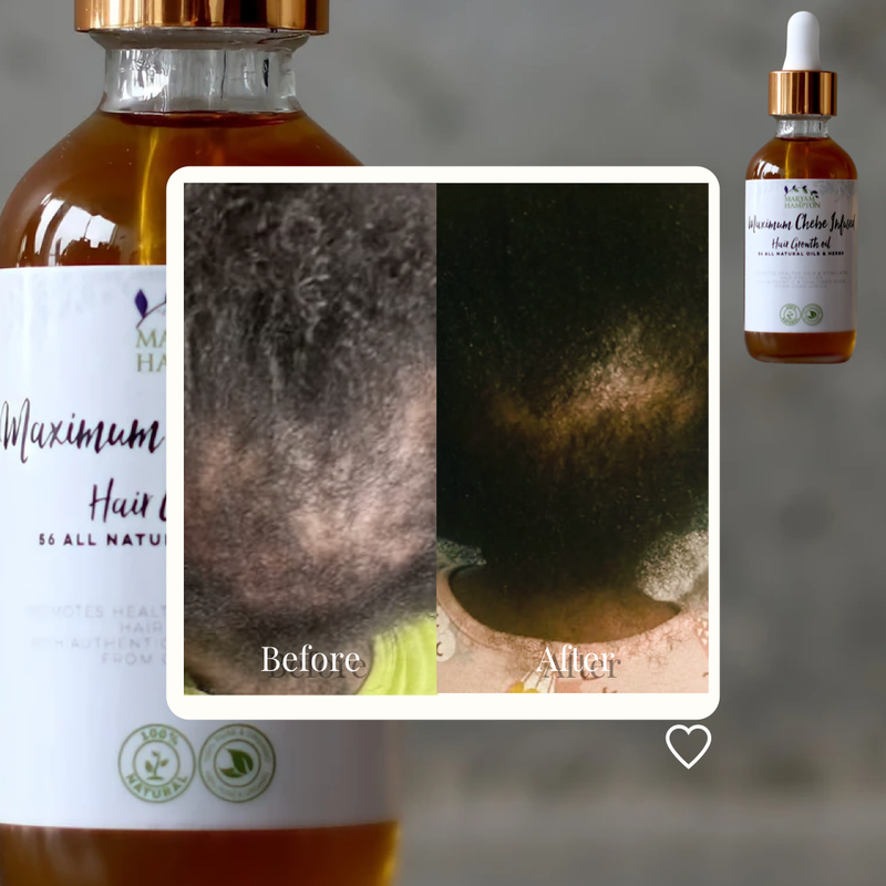 Maximum Chebe Infused Hair Growth Oil